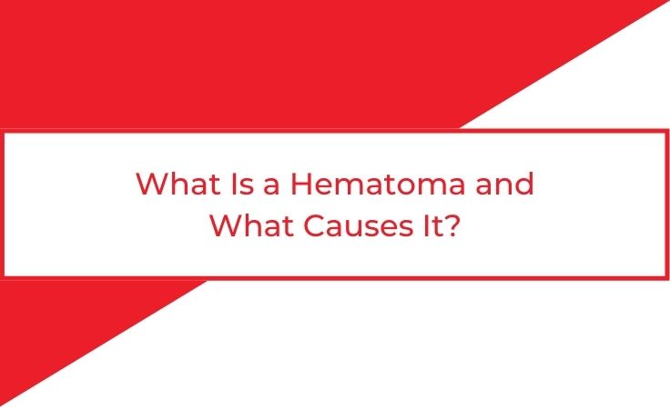 what is a hematoma and what causes it
